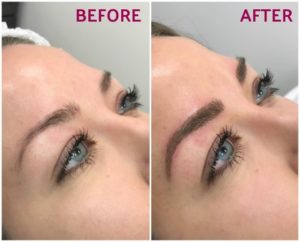 Microblading Tags'massages spa near me; spas in near me; facials spas near me; spa and massages near me; day at the spa near me; spas near me for couples; best facials near me; massage and facial packages near me; best spa massages near me; massage and facials near me; couples day spa packages near me; skin facials near me; couples spa treatments near me; full body massage and facial near me; luxury day spa near me; facial therapist near me; pregnancy facials near me; good facials near me; day spa near me for couples; couples facial treatment near me; best spa treatment near me; massage and spa places near me; spas with massage near me; massage spa places near me; body facials near me; best spa and massages near me; facial spa treatment near me; upscale massage spa near me; spa for massage near me; spa for facial near me; facials and spa near me; massage day spa near me; day spa near me massage; best spa for facial near me; therapeutic spas near me; day spa and massage near me; spa massage and facial near me; spas treatments near me; salon spas near me; relaxation spa near me; full day spa package near me; couples day spa near me; salon facial near me; body massages spa near me; best place for facials near me; day spa packages near memassages spa near me; spas in near me; facials spas near me; spa and massages near me; day at the spa near me; spas near me for couples; best facials near me; massage and facial packages near me; best spa massages near me; massage and facials near me; couples day spa packages near me; skin facials near me; couples spa treatments near me; full body massage and facial near me; luxury day spa near me; facial therapist near me; pregnancy facials near me; good facials near me; day spa near me for couples; couples facial treatment near me; best spa treatment near me; massage and spa places near me; spas with massage near me; massage spa places near me; body facials near me; best spa and massages near me; facial spa treatment near me; upscale massage spa near me; spa for massage near me; spa for facial near me; facials and spa near me; massage day spa near me; day spa near me massage; best spa for facial near me; therapeutic spas near me; day spa and massage near me; spa massage and facial near me; spas treatments near me; salon spas near me; relaxation spa near me; full day spa package near me; couples day spa near me; salon facial near me; body massages spa near me; best place for facials near me; day spa packages near me Skincare Science; Spa Treatments; Spa Makeover;, body products; medspa; anti-aging; anti-aging injections; derma fillers; hydroglo; healite; aesthetics treatments; facial cosmetics; massages spa near me, spas in near me, facials spas near me, spa and massages near me, day at the spa near me, spas near me for couples, best facials near me, massage and facial packages near me, best spa massages near me, massage and facials near me, couples day spa packages near me, skin facials near me, couples spa treatments near me, full body massage and facial near me, luxury day spa near me, facial therapist near me, pregnancy facials near me, good facials near me, day spa near me for couples, couples facial treatment near me, best spa treatment near me, massage and spa places near me, spas with massage near me, massage spa places near me, body facials near me, best spa and massages near me, facial spa treatment near me, upscale massage spa near me, spa for massage near me, spa for facial near me, facials and spa near me, massage day spa near me, day spa near me massage, best spa for facial near me, therapeutic spas near me, day spa and massage near me, spa massage and facial near me, spas treatments near me, salon spas near me, relaxation spa near me, full day spa package near me, couples day spa near me, salon facial near me, body massages spa near me, best place for facials near me, day spa packages near me Skincare Science, Spa Treatments, Spa Makeover, body products, medspa, anti-aging, anti-aging injections, derma fillers, hydroglo, healite, facial cosmetics, aesthetics treatments
